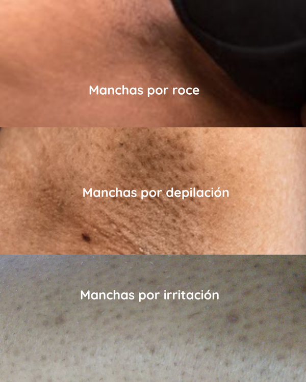 ACLARANTE
