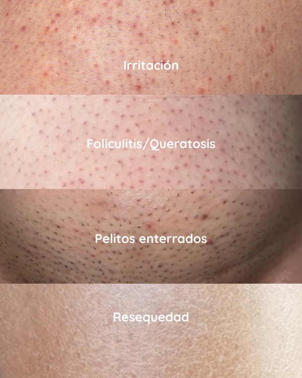 EXFOLIANTE