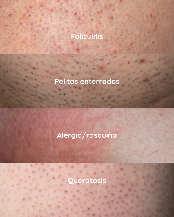 KIT PIEL SEDA